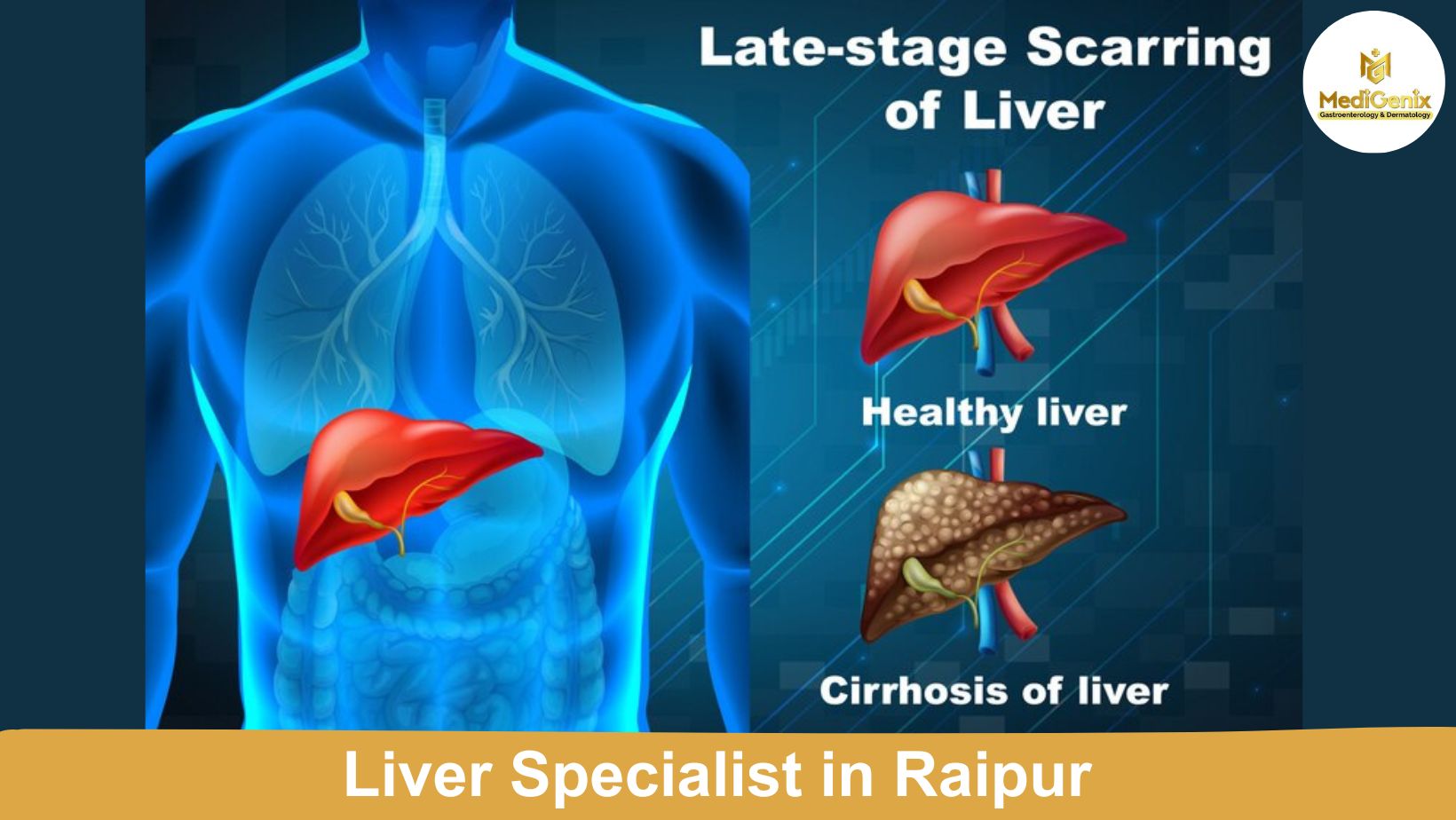 Liver Specialist in Raipur